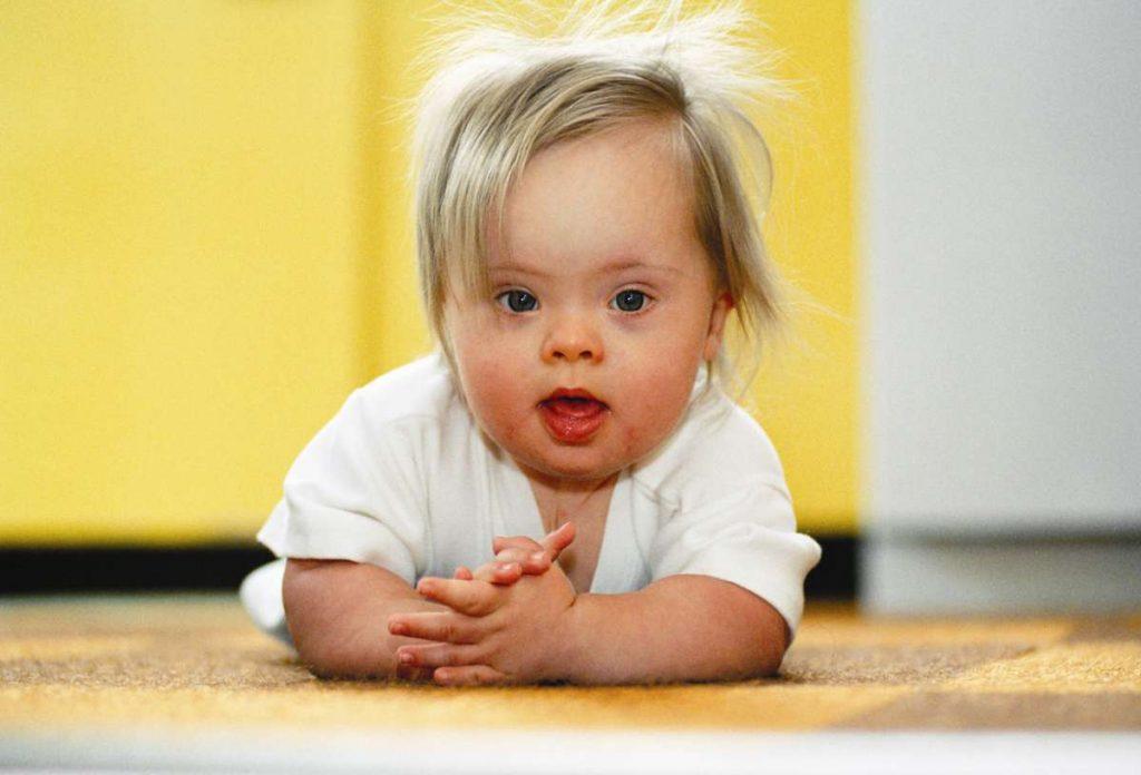 Всемирный день людей с синдромом Дауна