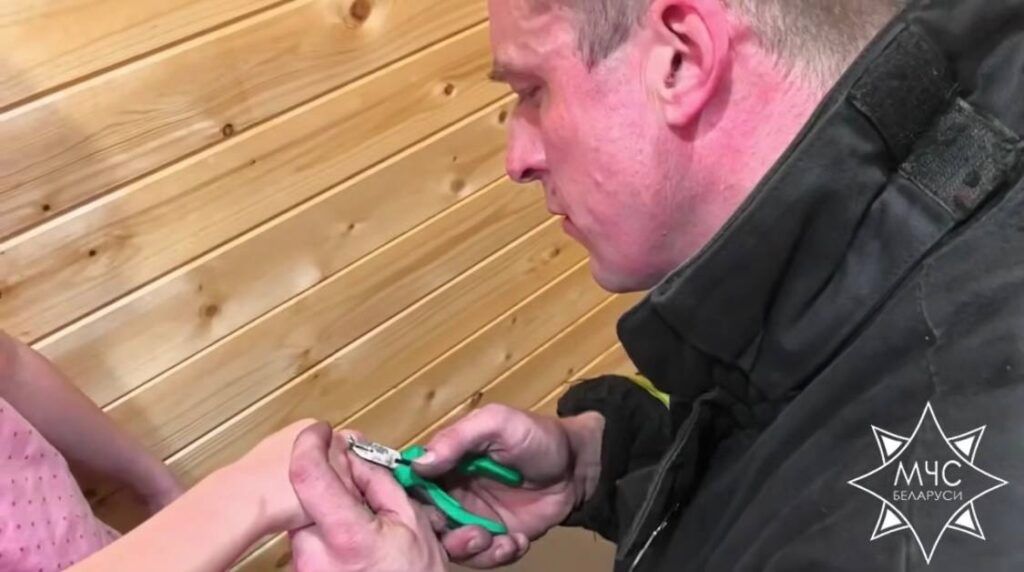 Тонкая работа. Узденские спасатели помогли ребенку снять кольцо